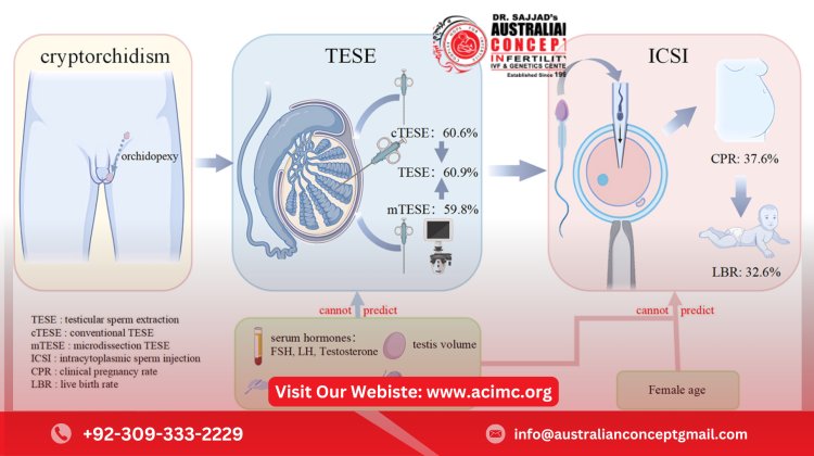 What Are the Common Methods Used in Azoospermia Treatment