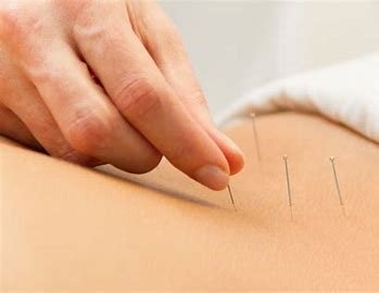 Average Cost of Acupuncture for Chronic Pain & Stress Treatment