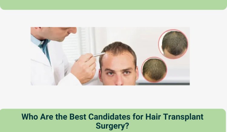 Who Are the Best Candidates for Hair Transplant Surgery?